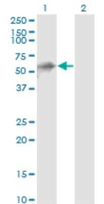 Western Blot: KBTBD10 Antibody (1H3) [H00010324-M01]