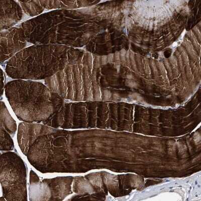 Immunohistochemistry-Paraffin: KBTBD10 Antibody [NBP1-80786]