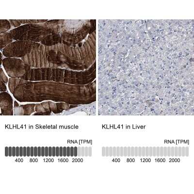 Immunohistochemistry-Paraffin: KBTBD10 Antibody [NBP1-80786]