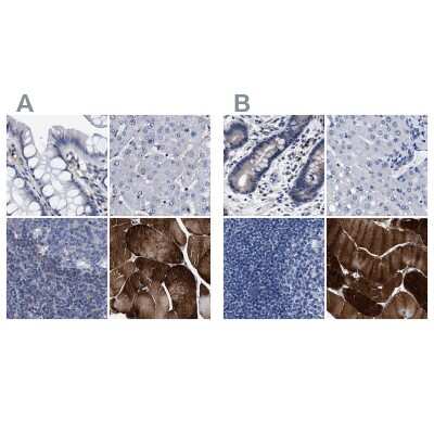 Immunohistochemistry-Paraffin: KBTBD10 Antibody [NBP1-80786]