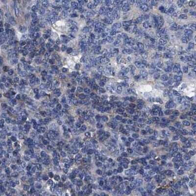 Immunohistochemistry-Paraffin: KBTBD10 Antibody [NBP1-80786]