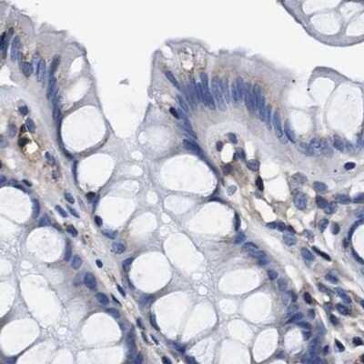 Immunohistochemistry-Paraffin: KBTBD10 Antibody [NBP1-80786]