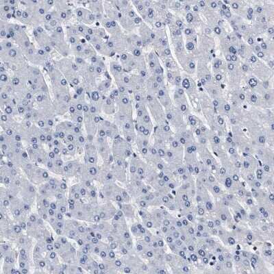 Immunohistochemistry-Paraffin: KBTBD10 Antibody [NBP1-80787]
