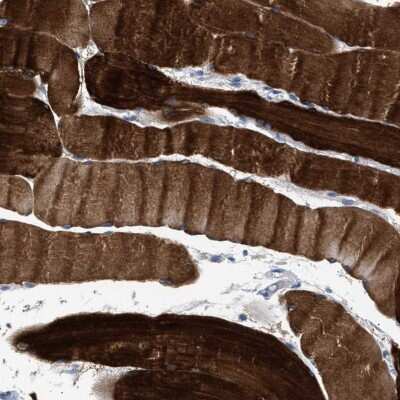Immunohistochemistry-Paraffin: KBTBD10 Antibody [NBP1-80787]