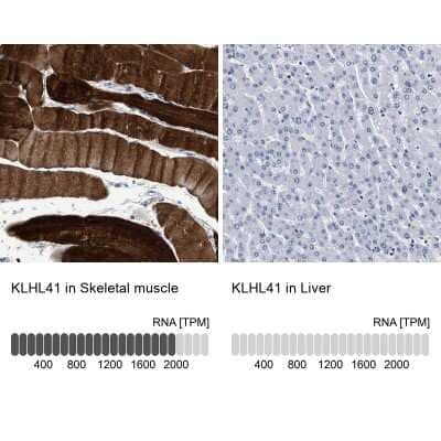 Immunohistochemistry-Paraffin: KBTBD10 Antibody [NBP1-80787]