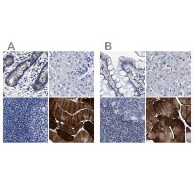 Immunohistochemistry-Paraffin: KBTBD10 Antibody [NBP1-80787]