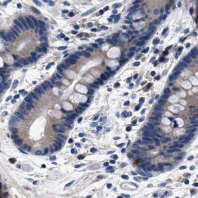 Immunohistochemistry-Paraffin: KBTBD10 Antibody [NBP1-80787]