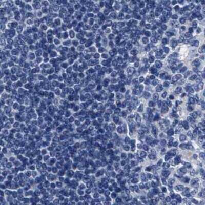 Immunohistochemistry-Paraffin: KBTBD10 Antibody [NBP1-80787]