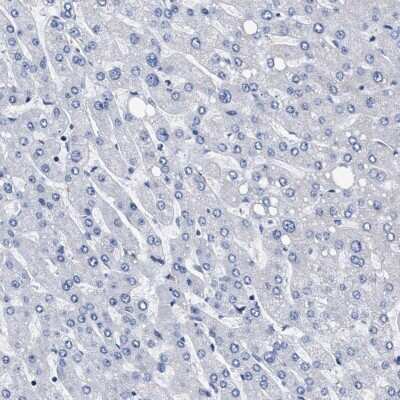 Immunohistochemistry-Paraffin: KBTBD10 Antibody [NBP1-80788]