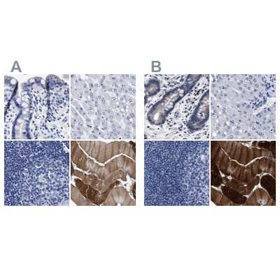 Immunohistochemistry-Paraffin: KBTBD10 Antibody [NBP1-80788]