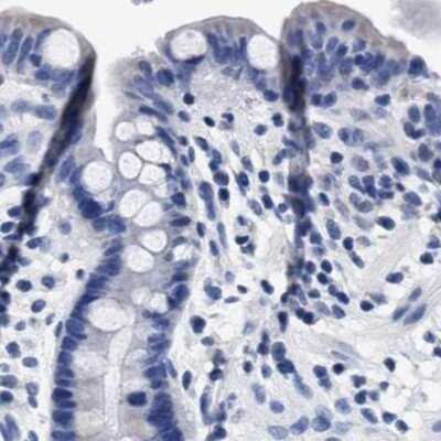 Immunohistochemistry-Paraffin: KBTBD10 Antibody [NBP1-80788]