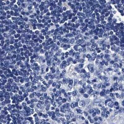 Immunohistochemistry-Paraffin: KBTBD10 Antibody [NBP1-80788]