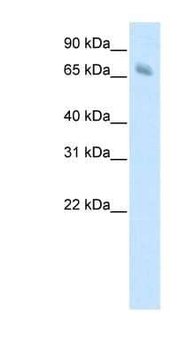 Western Blot: KBTBD10 Antibody [NBP1-80310]