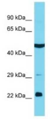 Western Blot: KBTBD12 Antibody [NBP3-09741]