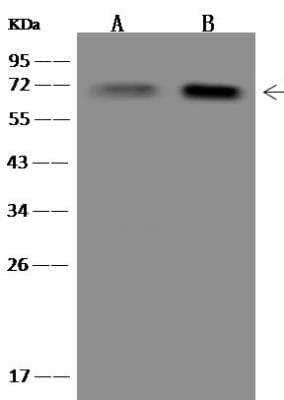 Western Blot: KBTBD12 Antibody [NBP3-12651]