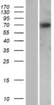 Western Blot: KBTBD12 Overexpression Lysate [NBP2-04490]