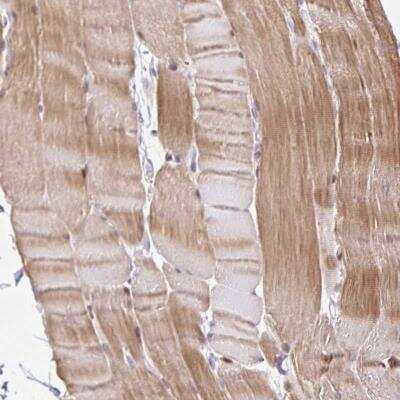 Immunohistochemistry-Paraffin: KBTBD13 Antibody [NBP2-32369]