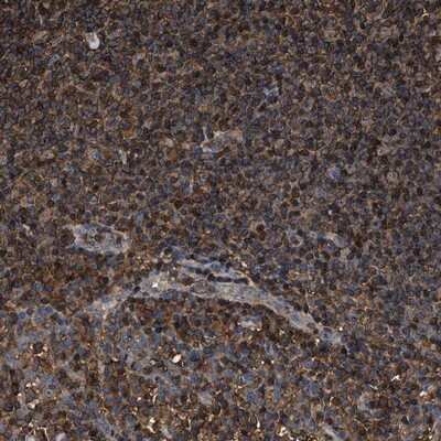 Immunohistochemistry-Paraffin: KBTBD2 Antibody [NBP1-88588]