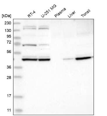 Western Blot: KBTBD2 Antibody [NBP1-88588]