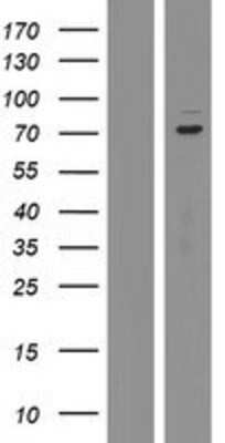 Western Blot: KBTBD2 Overexpression Lysate [NBP2-07163]