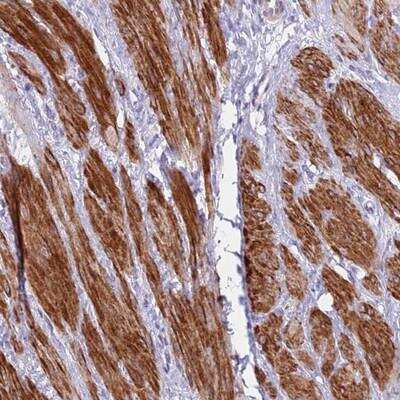 Immunohistochemistry-Paraffin: KBTBD3 Antibody [NBP2-14592]