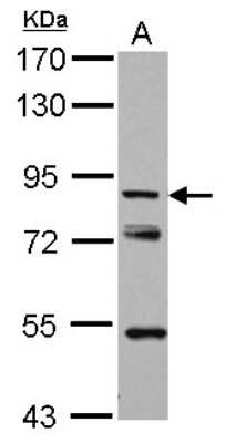 Western Blot: KBTBD3 Antibody [NBP2-17022]