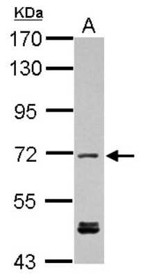 Western Blot: KBTBD3 Antibody [NBP2-17023]