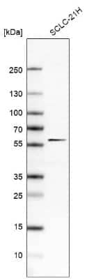 Western Blot: KBTBD4 Antibody [NBP1-88587]