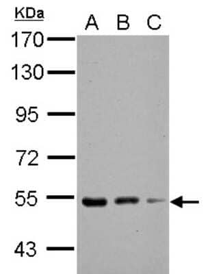 Western Blot: KBTBD4 Antibody [NBP2-17024]