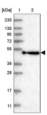 Western Blot: KBTBD4 Antibody [NBP2-38363]