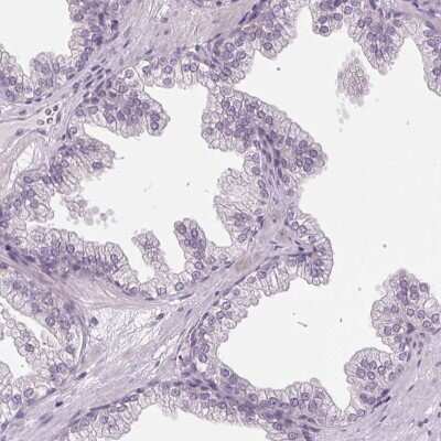 Immunohistochemistry-Paraffin: KBTBD5 Antibody [NBP2-38664]