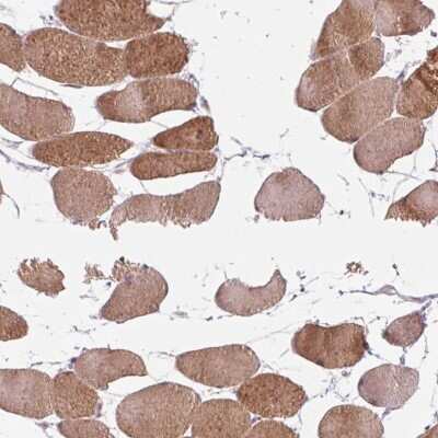 Immunohistochemistry-Paraffin: KBTBD5 Antibody [NBP2-38664]