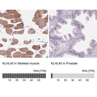 Immunohistochemistry-Paraffin: KBTBD5 Antibody [NBP2-38664]
