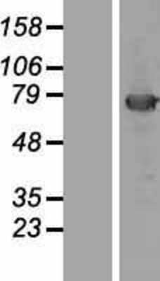 Western Blot: KBTBD5 Overexpression Lysate [NBL1-12133]