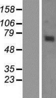 Western Blot: KBTBD6 Overexpression Lysate [NBP2-05294]