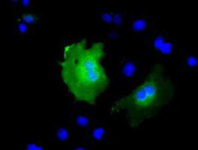 Immunocytochemistry/ Immunofluorescence: KBTBD7 Antibody (OTI1G3) [NBP2-02742]