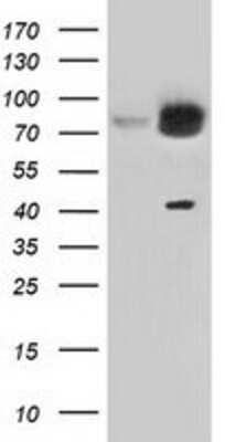 Western Blot: KBTBD7 Antibody (OTI1G3) [NBP2-02742]
