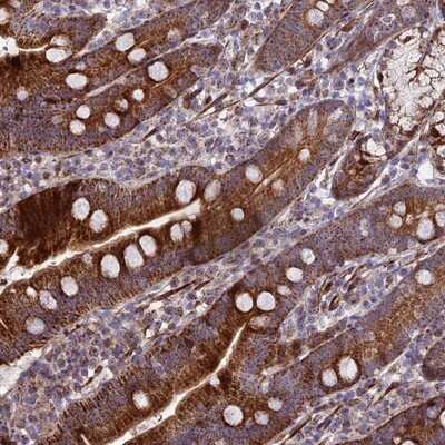 Immunohistochemistry-Paraffin: KBTBD7 Antibody [NBP1-92040]