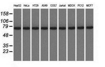 Western Blot: KBTBD7 Antibody (OTI1G3)Azide and BSA Free [NBP2-72268]