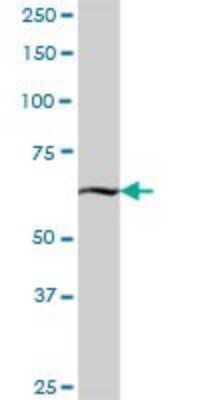 Western Blot: KBTBD7 Antibody [H00084078-B01P]