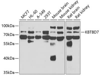 Western Blot: KBTBD7 AntibodyBSA Free [NBP3-05059]