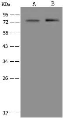 Western Blot: KBTBD7 Antibody [NBP3-12552]