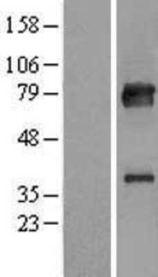 Western Blot: KBTBD7 Overexpression Lysate [NBL1-12135]