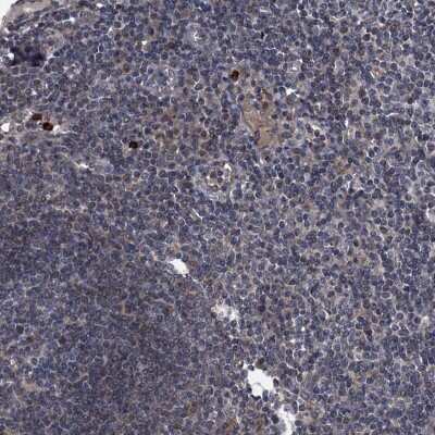 Immunohistochemistry-Paraffin: KBTBD8 Antibody [NBP1-93570]