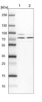 Western Blot: KBTBD8 Antibody [NBP1-93570]