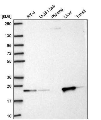 Western Blot: KBTBD8 Antibody [NBP2-56273]