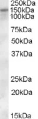 Western Blot: KCC1/SLC12A4 Antibody [NBP1-06043]