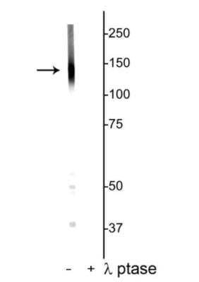 Western Blot: KCC2/SLC12A5 [p Thr1007] Antibody [NBP3-11949]