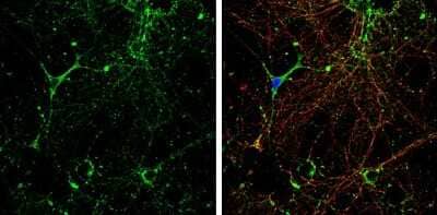 Immunocytochemistry/ Immunofluorescence: KCC2/SLC12A5 Antibody [NBP3-13161]