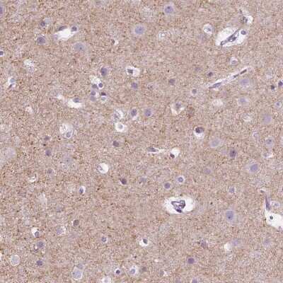 Immunohistochemistry-Paraffin: KCC2/SLC12A5 Antibody [NBP2-49674]